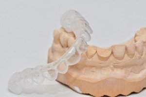 Zähneknirschen
